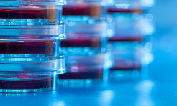 30 March 2023 - FAST RESPONSE WEBINAR: EPO Enlarged Board of Appeal decision G2/21 – post-filed data and the death of “plausibility”?